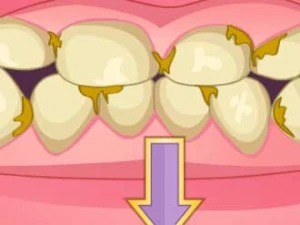 Bad Teeth Makeover - Play Free Best Care Online Game on JangoGames.com
